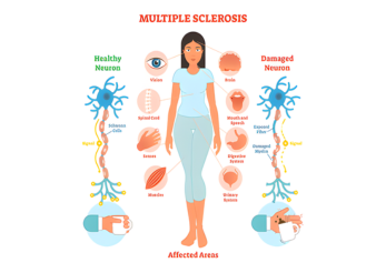 Autoimmune Neurological Disorders