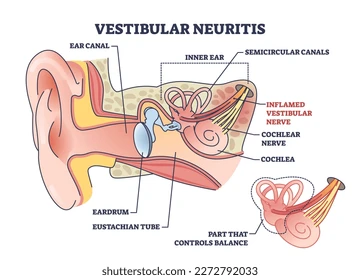 S4 - drguruprasadhneuropdspecialist.com Sleep Disorders