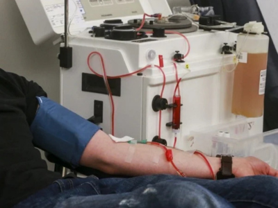 Plasmapheresis