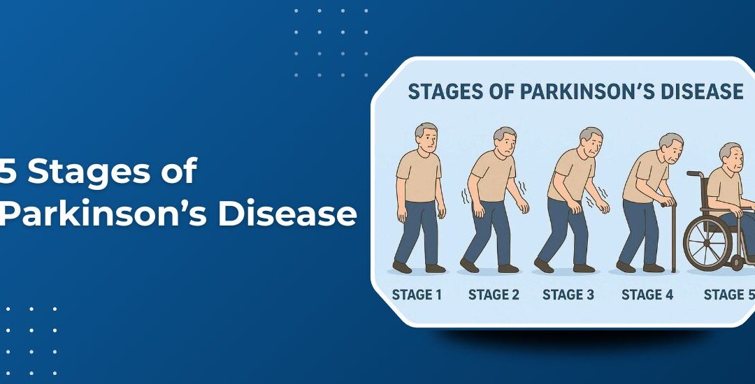 5 Stages of Parkinson’s Disease