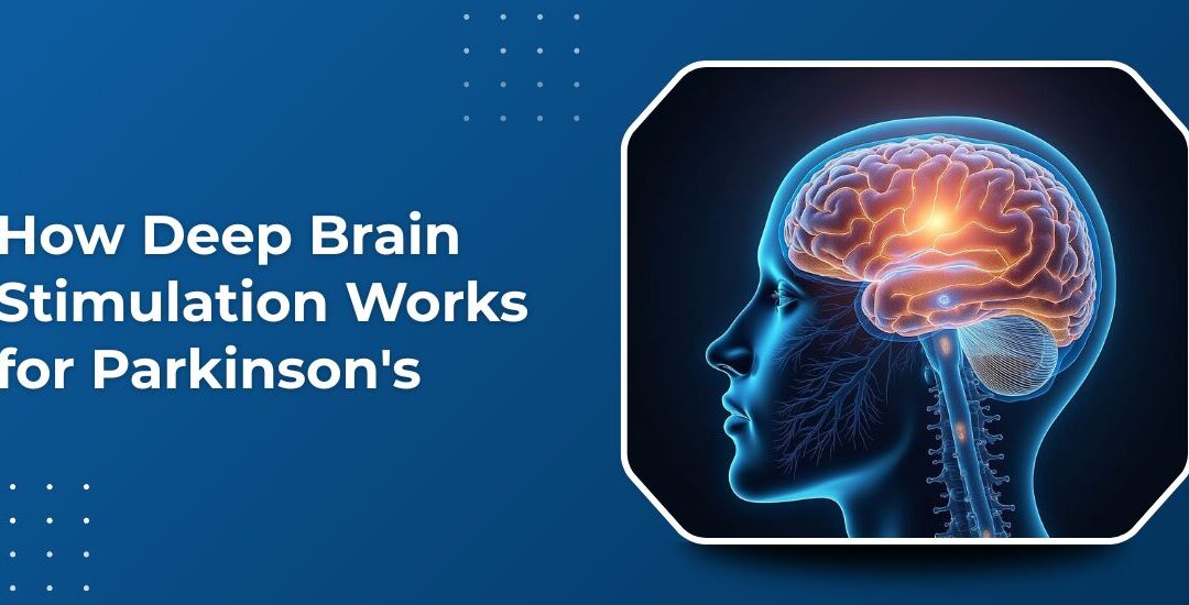 How Deep Brain Stimulation Works for Parkinson’s