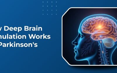 How Deep Brain Stimulation Works for Parkinson’s