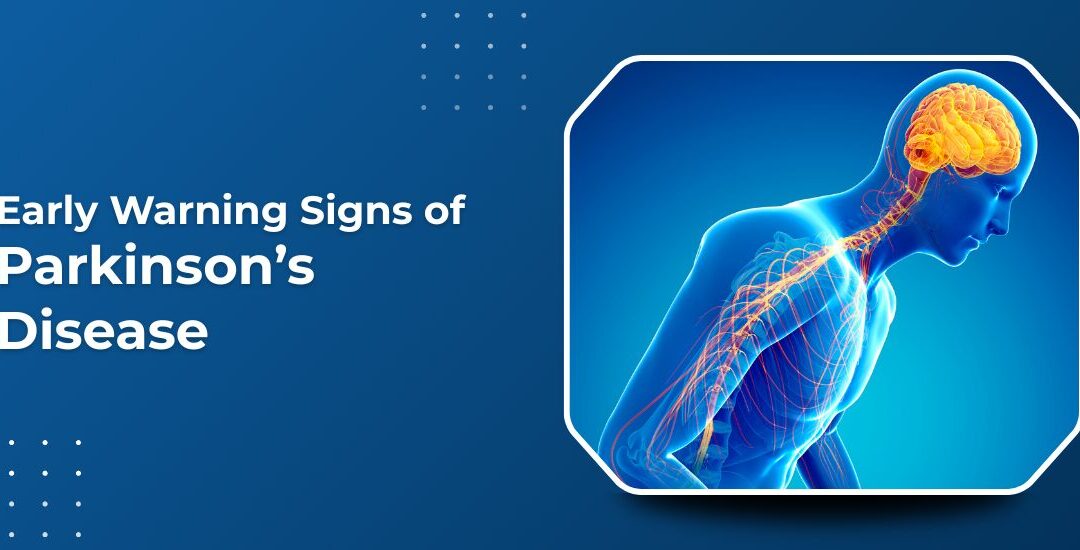 Early Warning Signs of Parkinson’s Disease