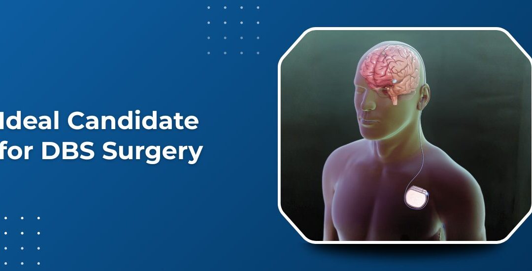 Ideal Candidate for DBS Surgery