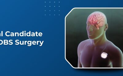 Ideal Candidate for DBS Surgery