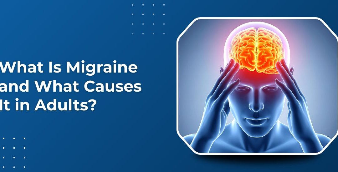 What Is Migraine and What Causes It in Adults?