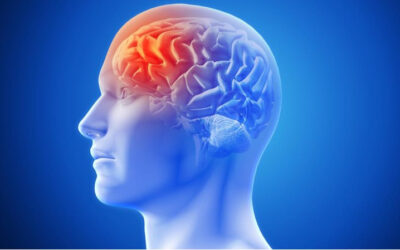 What Is Migraine and What Causes It in Adults?