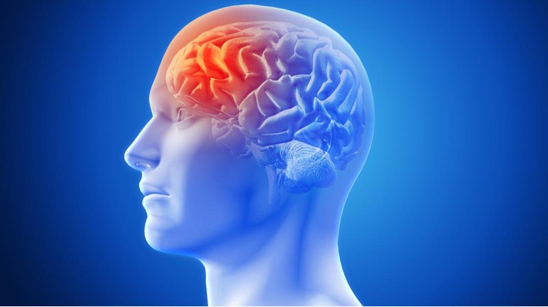 What Is Migraine and What Causes It in Adults?