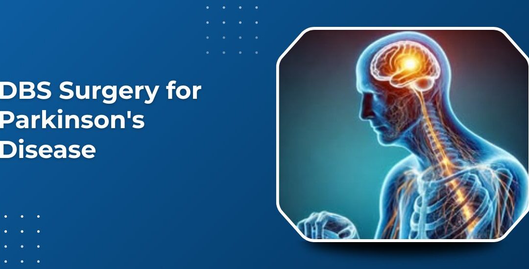 DBS Surgery for Parkinson’s Disease: Success Rates and Recovery Timeline in India