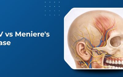 BPPV vs Meniere’s Disease: Understanding Different Types of Vertigo