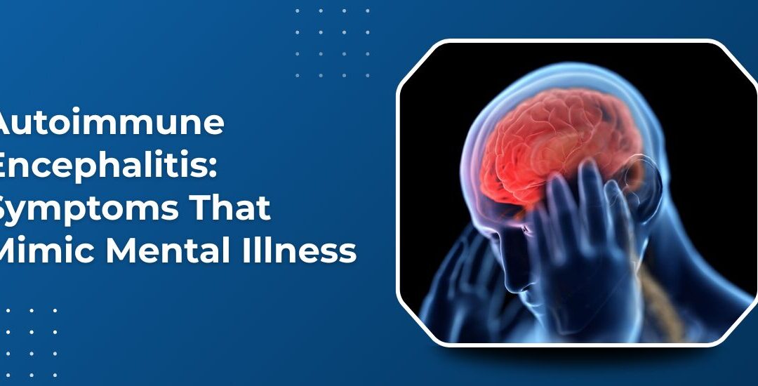 Autoimmune Encephalitis: Symptoms That Mimic Mental Illness