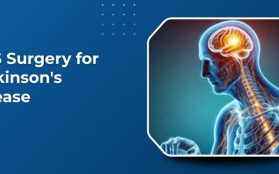 DBS Surgery for Parkinson’s Disease: Success Rates and Recovery Timeline in India