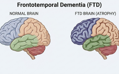 Autoimmune Neurological Disorders