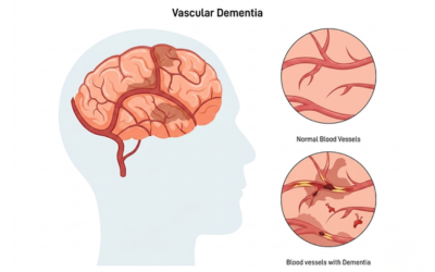 headaches-and-vertigo