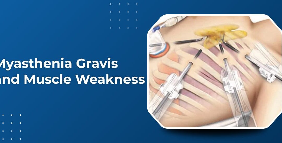 Myasthenia Gravis: Is Your Muscle Weakness Actually a Neurological Problem?