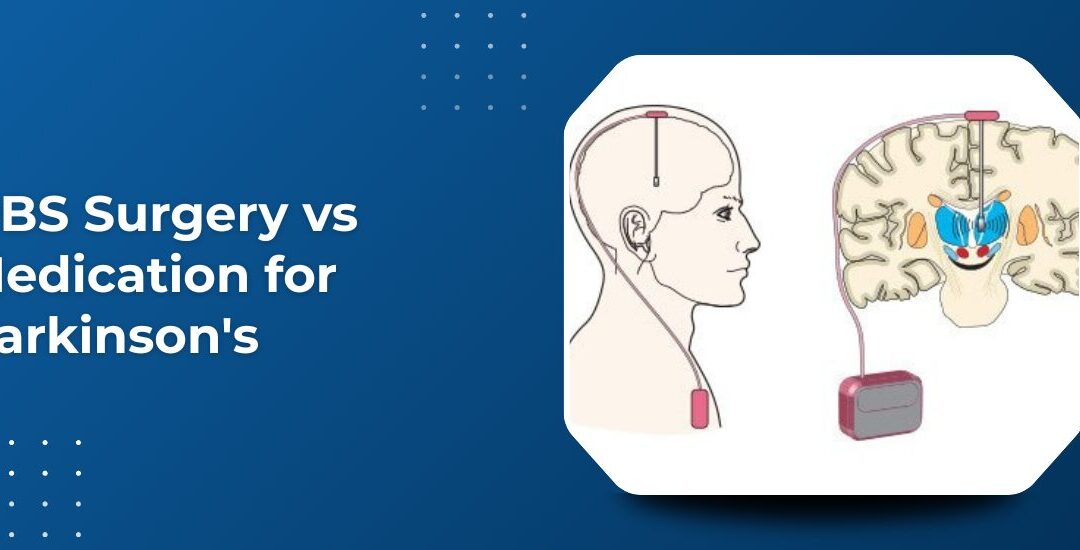DBS Surgery vs Medication for Parkinson’s: How Do You Know Which Option Is Right?