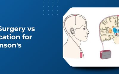 DBS Surgery vs Medication for Parkinson’s: How Do You Know Which Option Is Right?