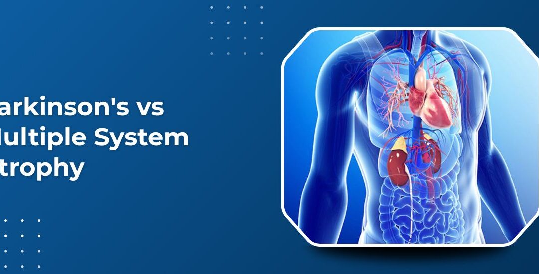 What Is the Difference Between Parkinson’s Disease and Multiple System Atrophy?