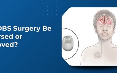 Can DBS Surgery Be Reversed or Removed at a Later Stage?