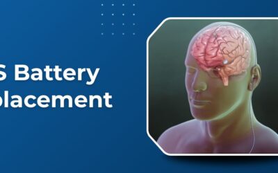 When Does a DBS Battery Need to Be Replaced?