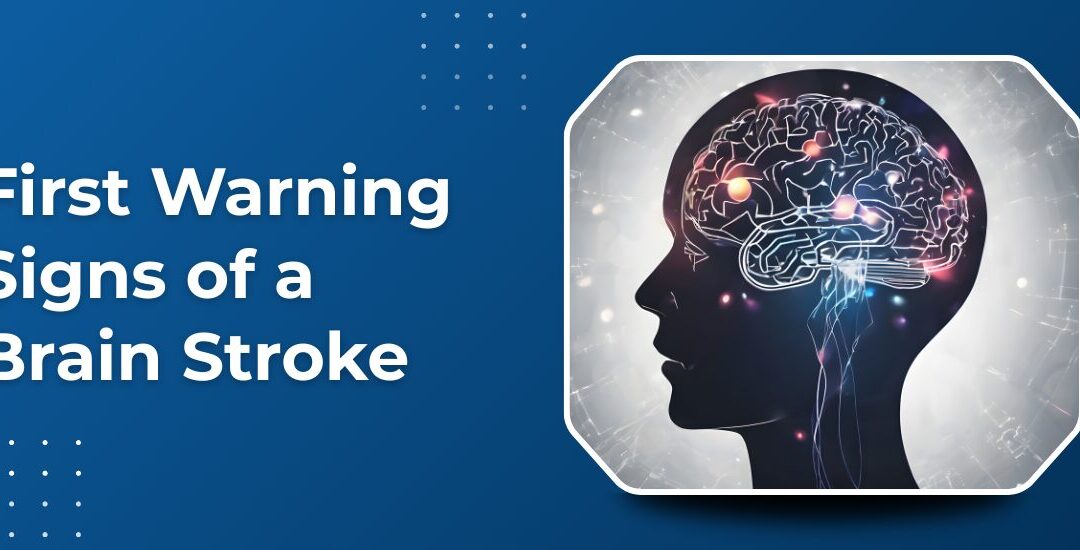 What Are the First Warning Signs of a Brain Stroke?