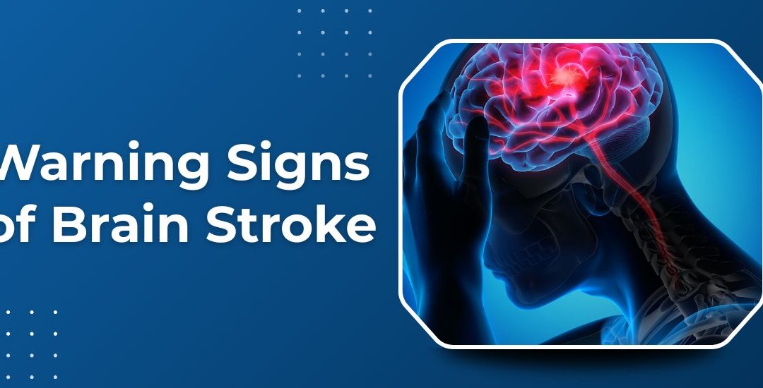 What Are the Warning Signs of a Brain Stroke?