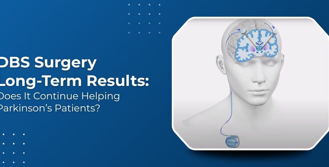DBS Surgery After 10 Years of Parkinson’s: Does It Still Work?