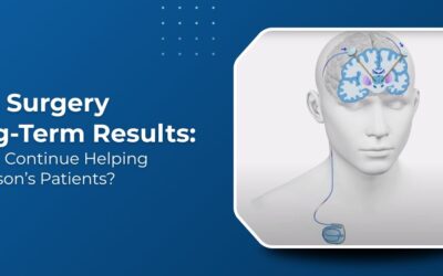 DBS Surgery After 10 Years of Parkinson’s: Does It Still Work?