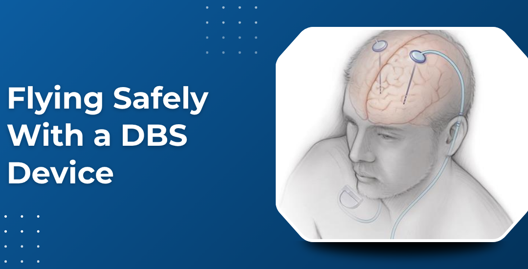 Is It Safe to Fly with a DBS Device Implanted?