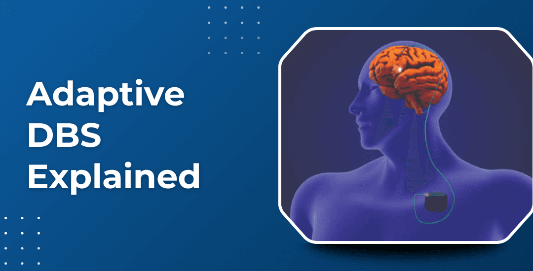 Adaptive DBS: How Does It Adjust to Your Brain in Real Time?