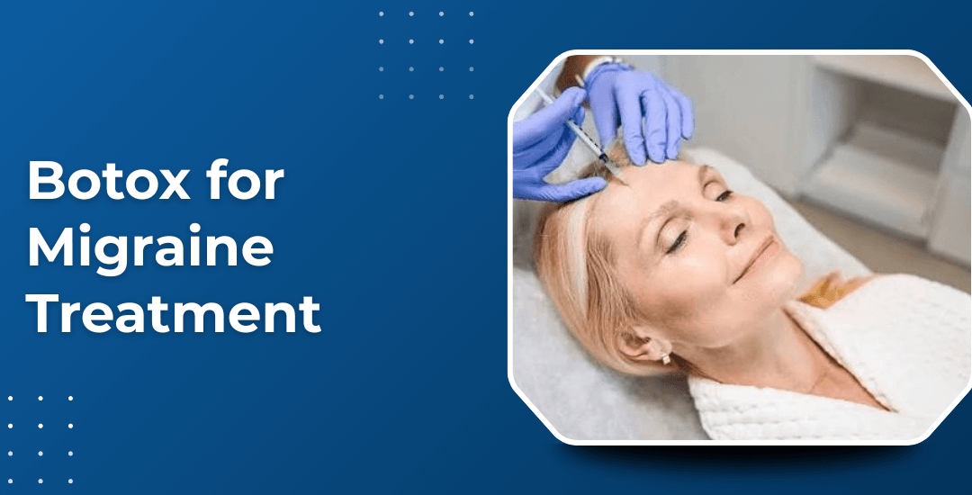 Botox for Migraine: What to Expect from Treatment?