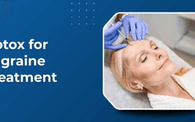 Botox for Migraine: What to Expect from Treatment?