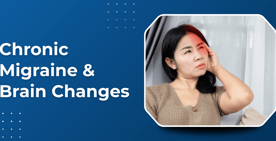 Can Chronic Migraine Lead to Permanent Brain Changes?