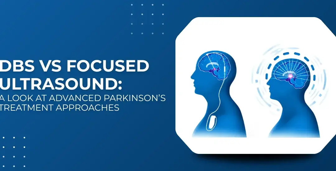 DBS vs Focused Ultrasound for Parkinson’s Tremor: Which Is Better?