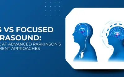 DBS vs Focused Ultrasound for Parkinson’s Tremor: Which Is Better?