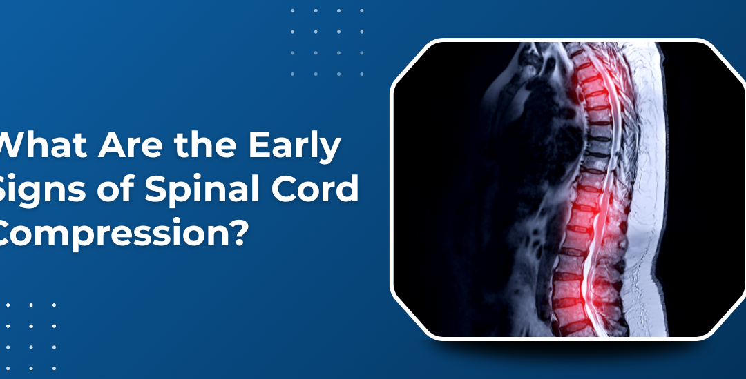 What Are the Early Signs of Spinal Cord Compression?