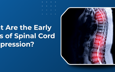 What Are the Early Signs of Spinal Cord Compression?