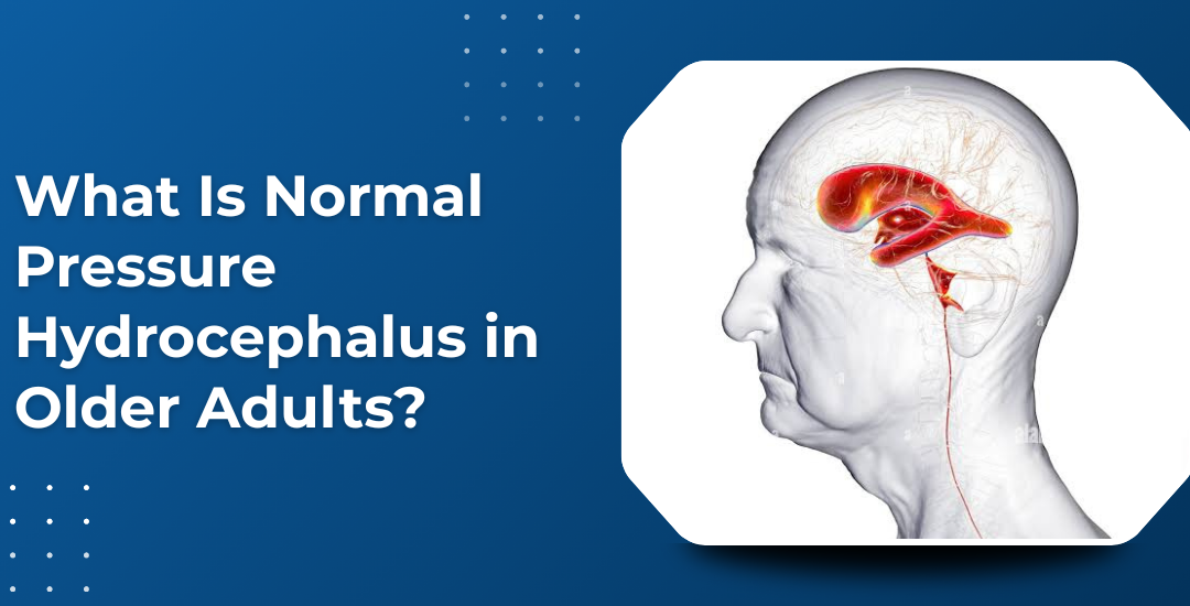 What Is Normal Pressure Hydrocephalus in Older Adults?