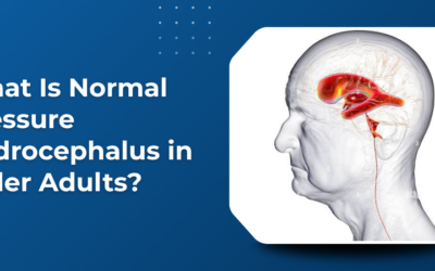 What Is Normal Pressure Hydrocephalus in Older Adults?