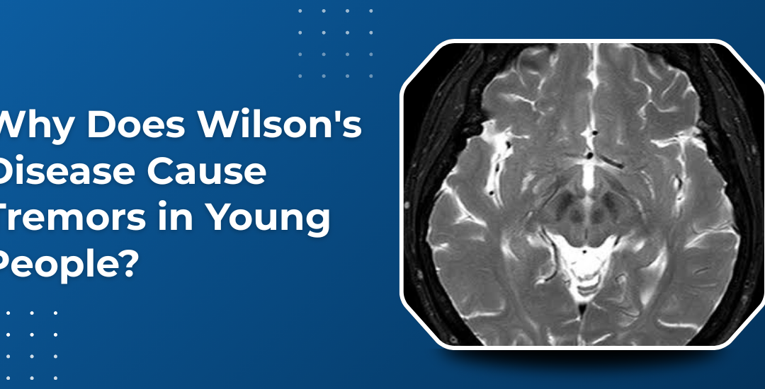 Why Does Wilson’s Disease Cause Tremors in Young People?