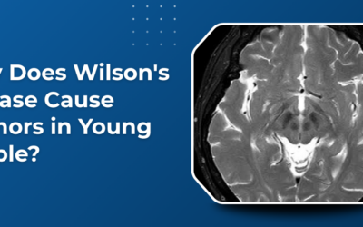 Why Does Wilson’s Disease Cause Tremors in Young People?